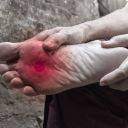 leg paw pain